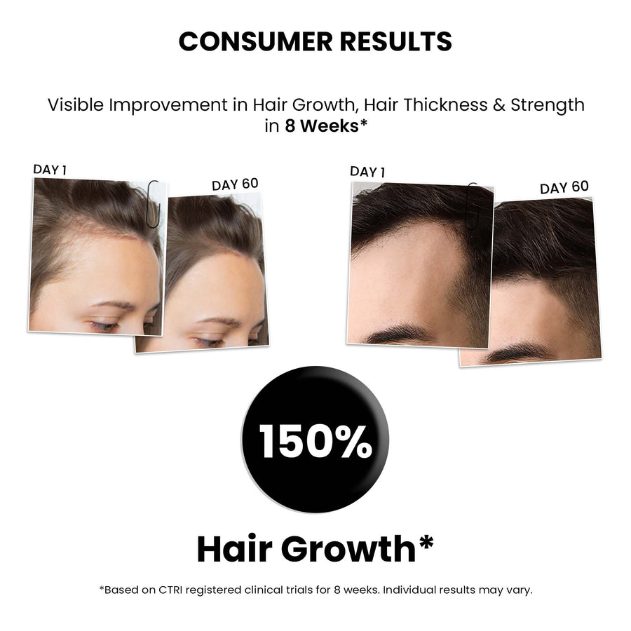 ThriveCo Hair Growth Serum 2.0 Spray For Men & Women, 50ML