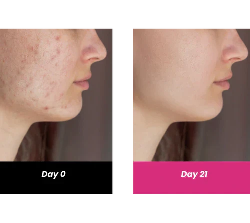 Thriveco 10% Vitamin C+ Hyaluronic Acid Serum | Hydrates & Brightens | Non Sticky Non Fragrance | Men & Women | 30ml