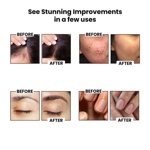 ThriveCo Cold-Pressed Jamaican Black Castor Oil | For Healthy Hair, Skin, Eyebrows, Eyelashes & Nails | For Men & Women (50ml)