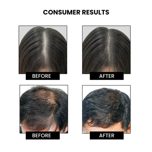 ThriveCo Hair Vitalizing Rosemary Shampoo for Strong Hair, Healthy Growth |  250ml