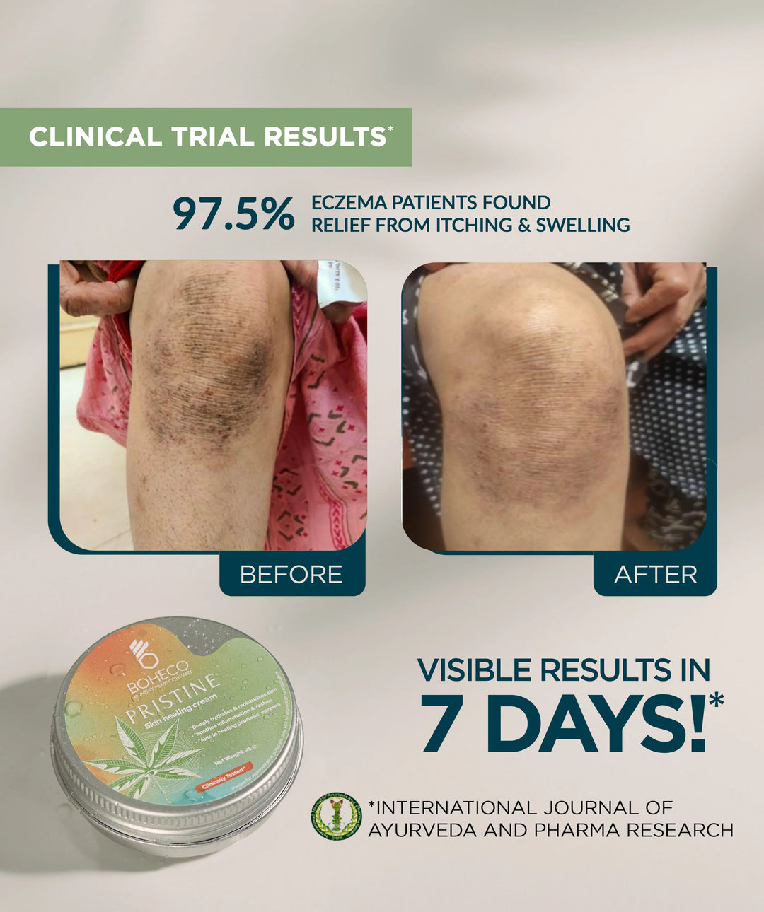 Boheco PRISTINE - Skin Healing Cream - 25gms