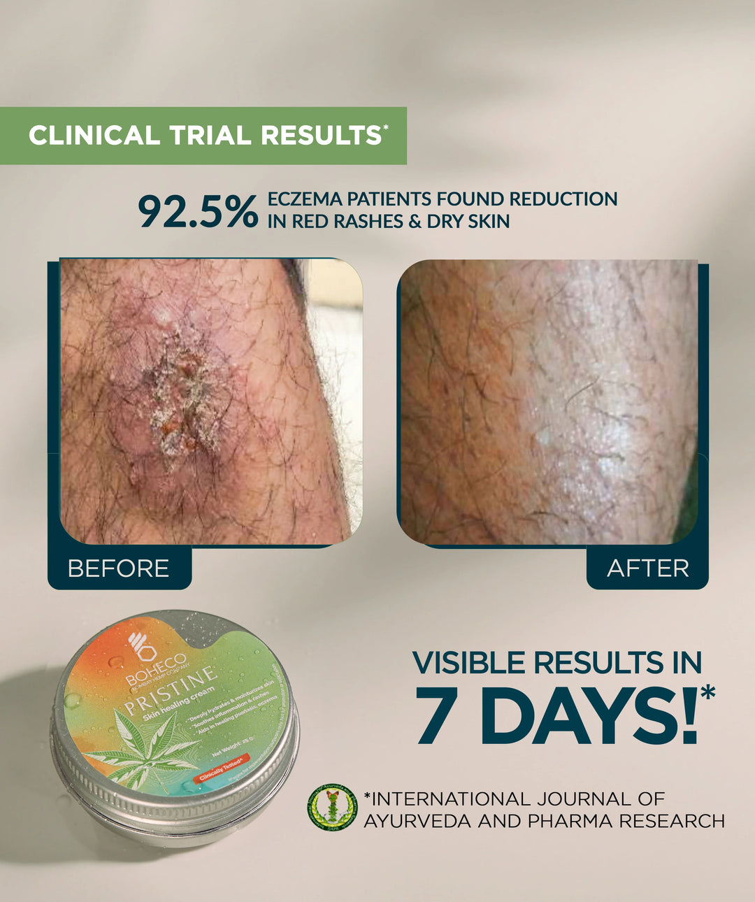 Boheco PRISTINE - Skin Healing Cream - 25gms