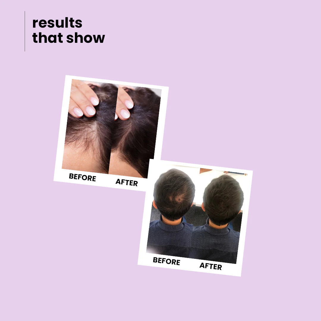 Growth Boost Shampoo | Hair-Fall Control Cleanser