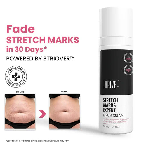ThriveCo Stretch Mark Expert Serum Cream - 30 ml