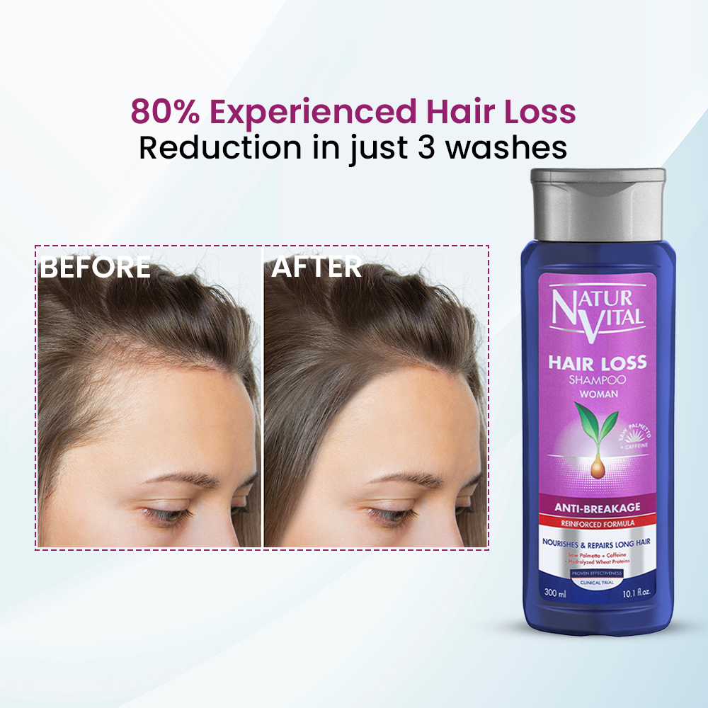 NaturVital Anti-Breakage Shampoo for Woman- 300ml
