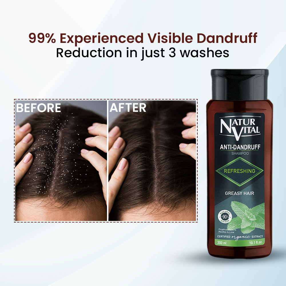 NaturVital Anti-Dandruff Refreshing Shampoo for Greasy Hair – 300ml