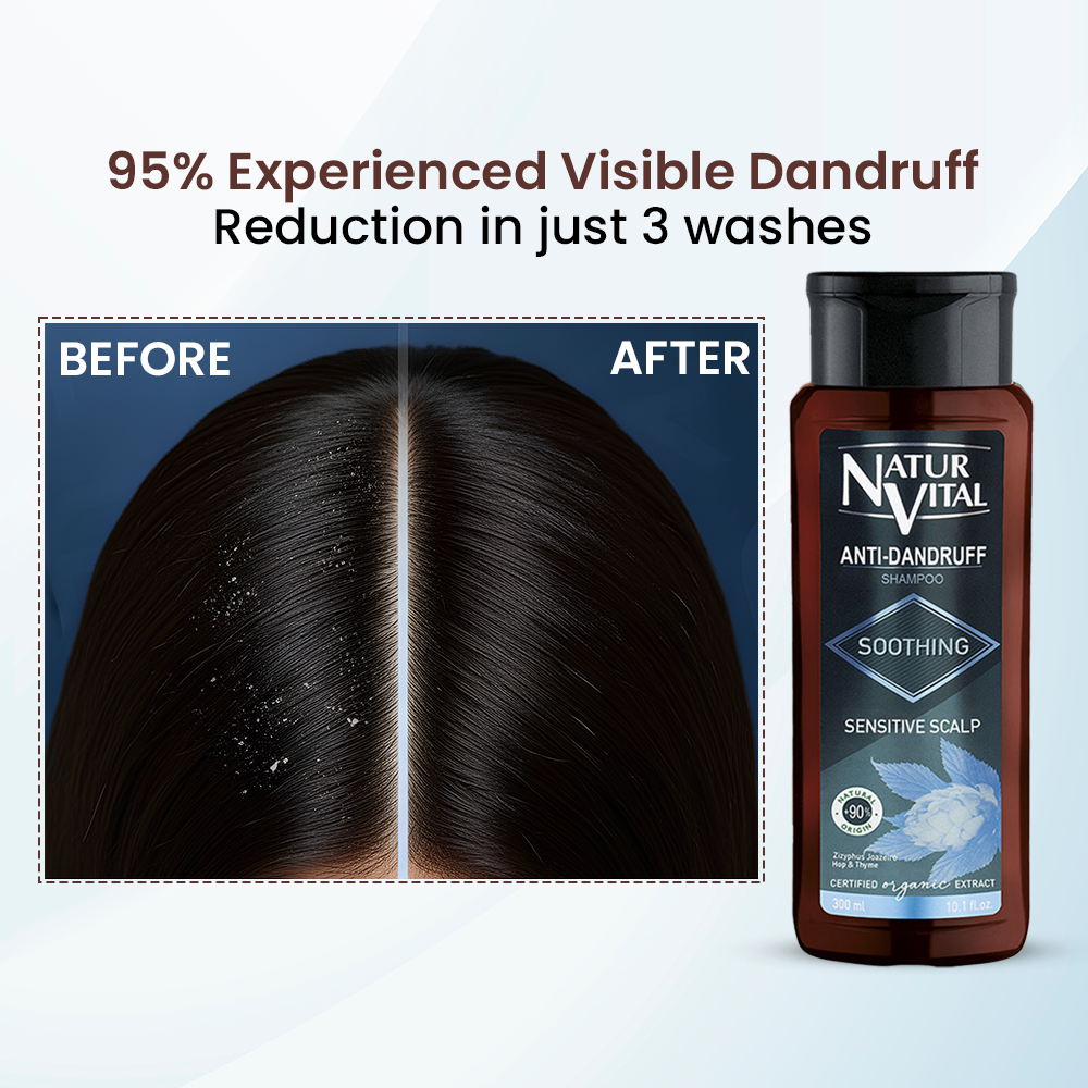 NaturVital Anti-Dandruff Soothing Shampoo – 300ml
