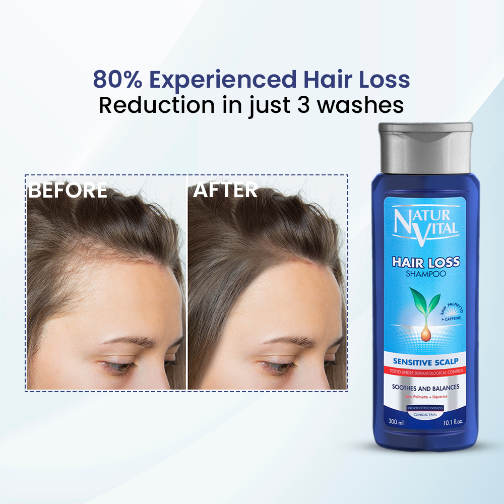 NaturVital Sensitive Hair Loss Shampoo – 300ml