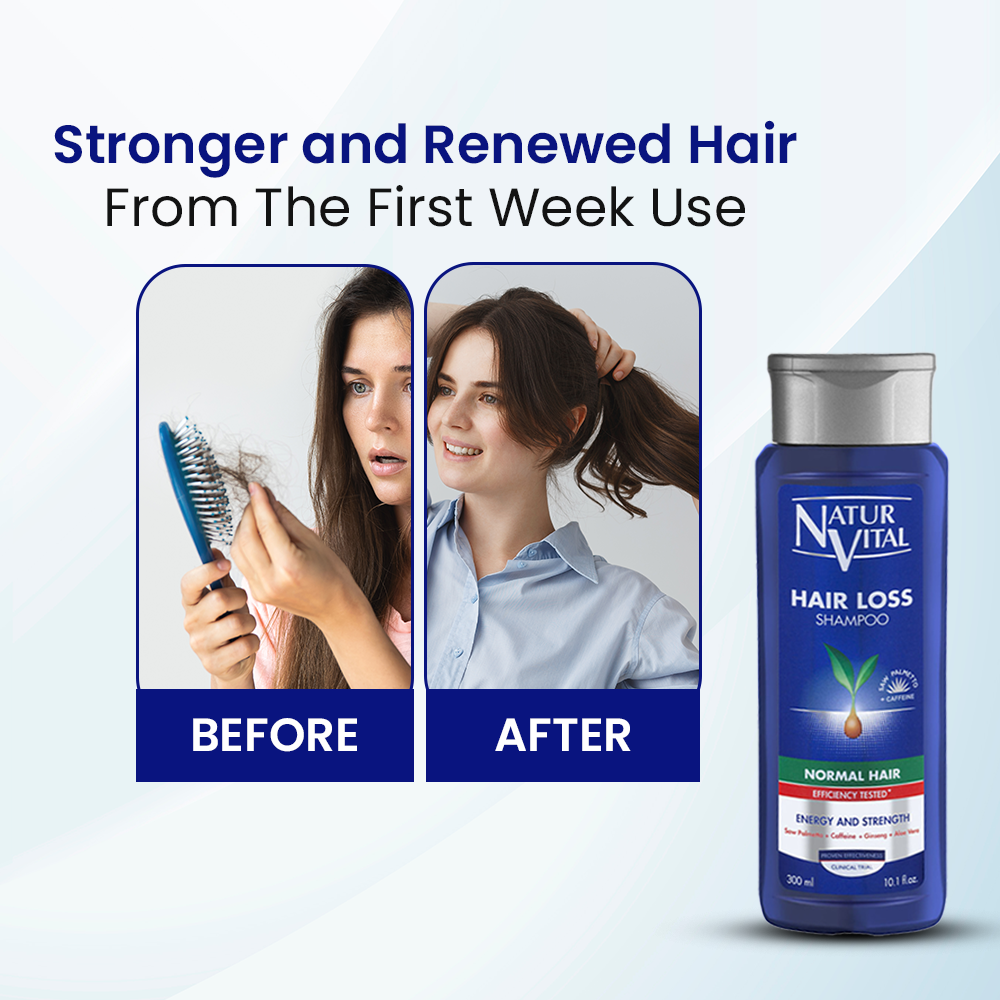 NaturVital Hair Loss Normal Hair Shampoo – 300ml