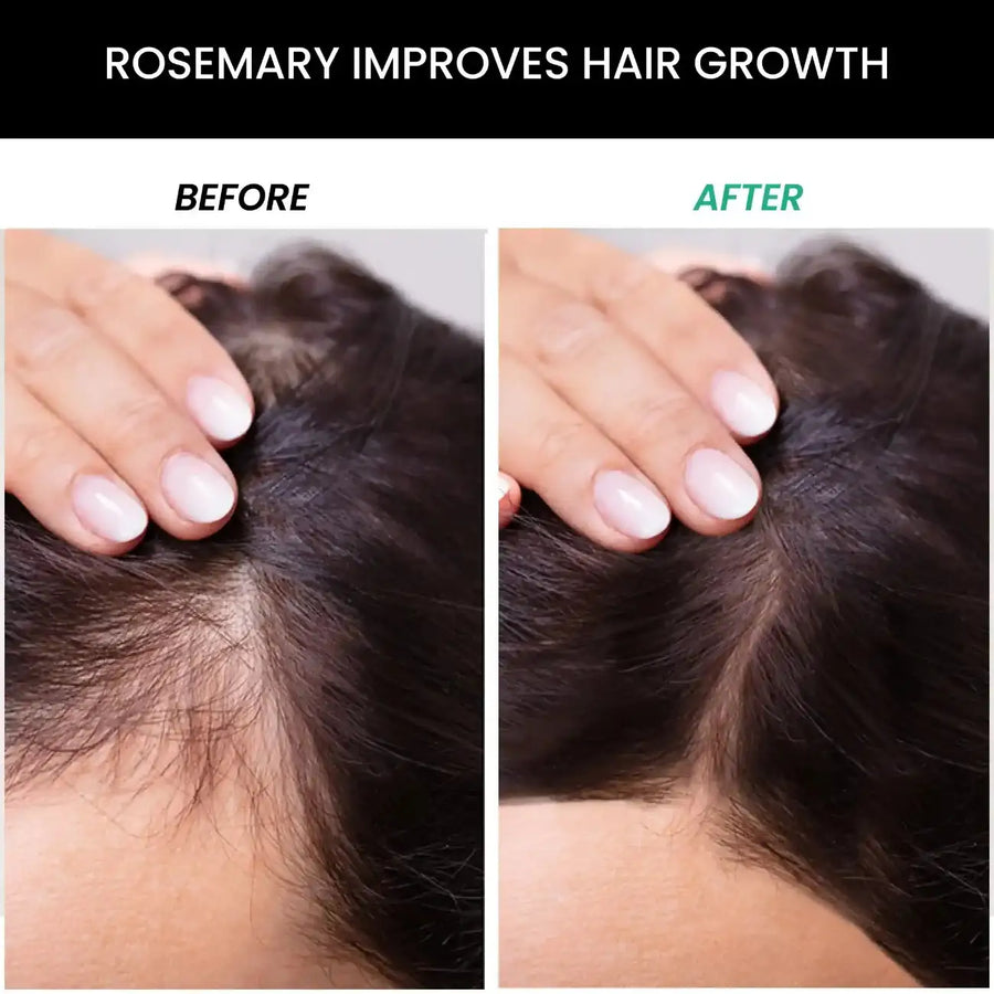 ThriveCo Anti Hair Fall Control Kit: Rosemary Shampoo, Conditioner, Essential Oil, Water
