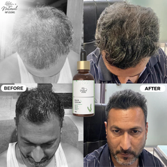 Natural Infusions Hair Growth Serum (50ml) | Redensyl, Anagain, Rosemary, Procapil, & Capila Longa | Controls Hair Fall | Increase Hair Density | For Men and Women