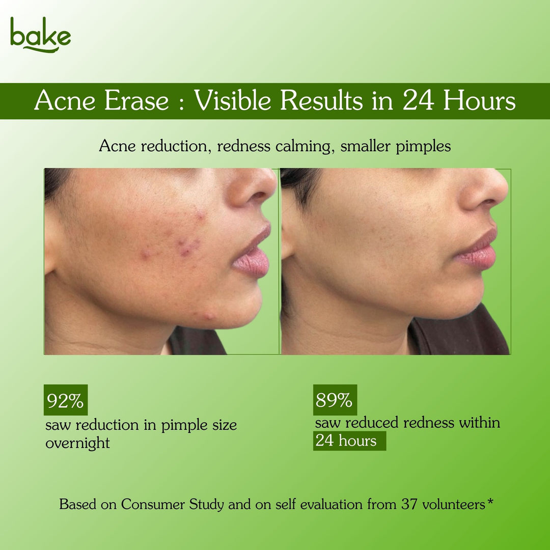 2% Salicylic Acid Serum