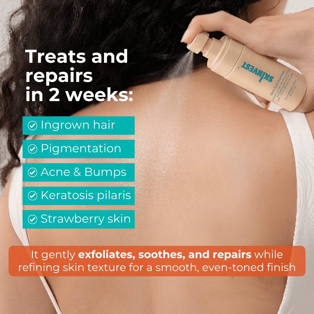 Skinvest Bye Bye Bumps 50ml For Men & Women