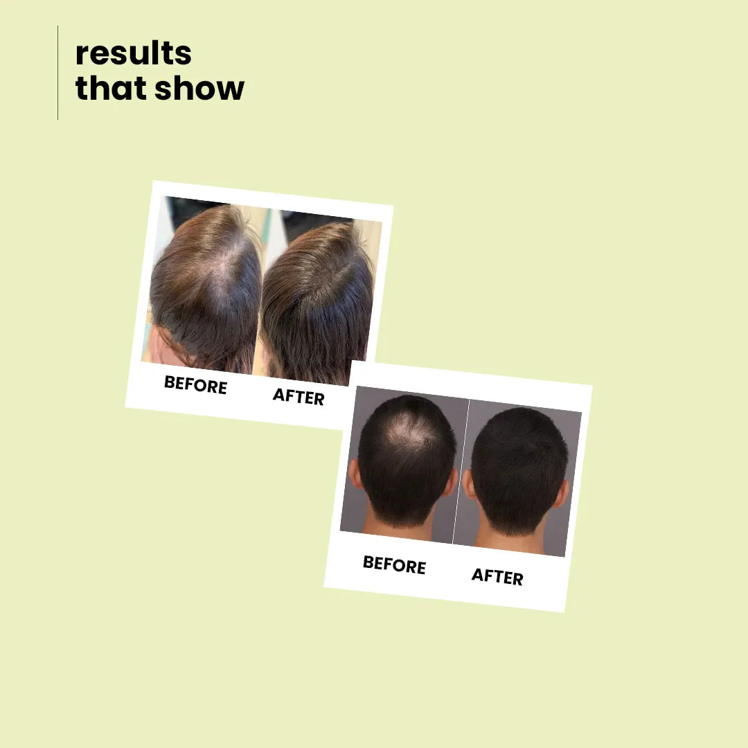 Repair Shampoo | Damaged Bond Repair Cleanser | Moroccan Argan Oil & Apple Cider | Men & Women