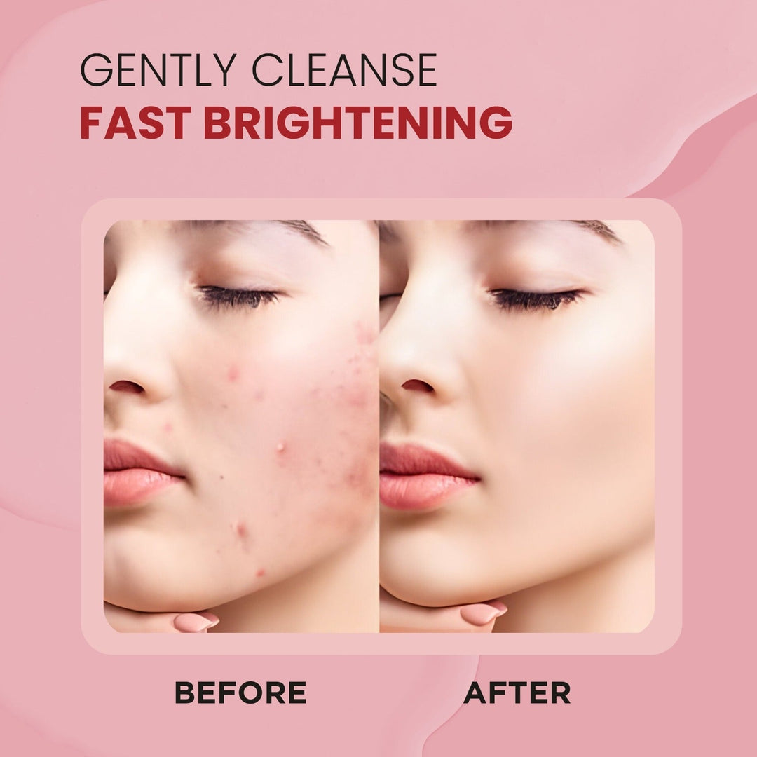 Bhoomi Herbal India STRWABERRY WITH HYALURONIC ACID FACE WASH