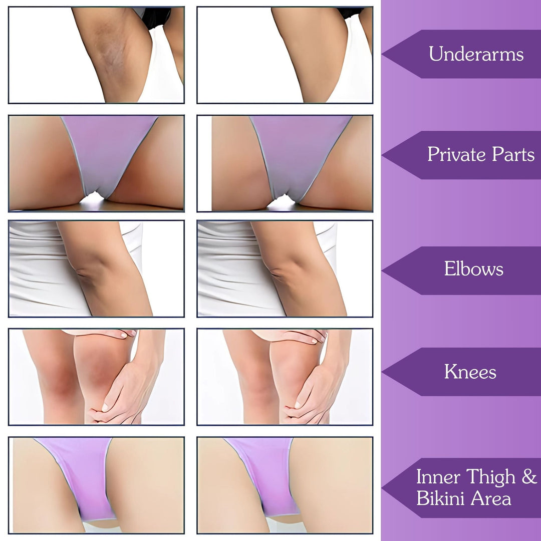 IntiErase™ Intimate Brightening Roll On Serum - Suspire