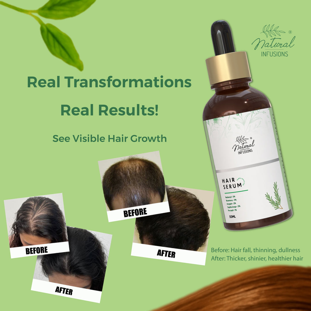 Natural Infusions In and Out Hair care pack - Suspire