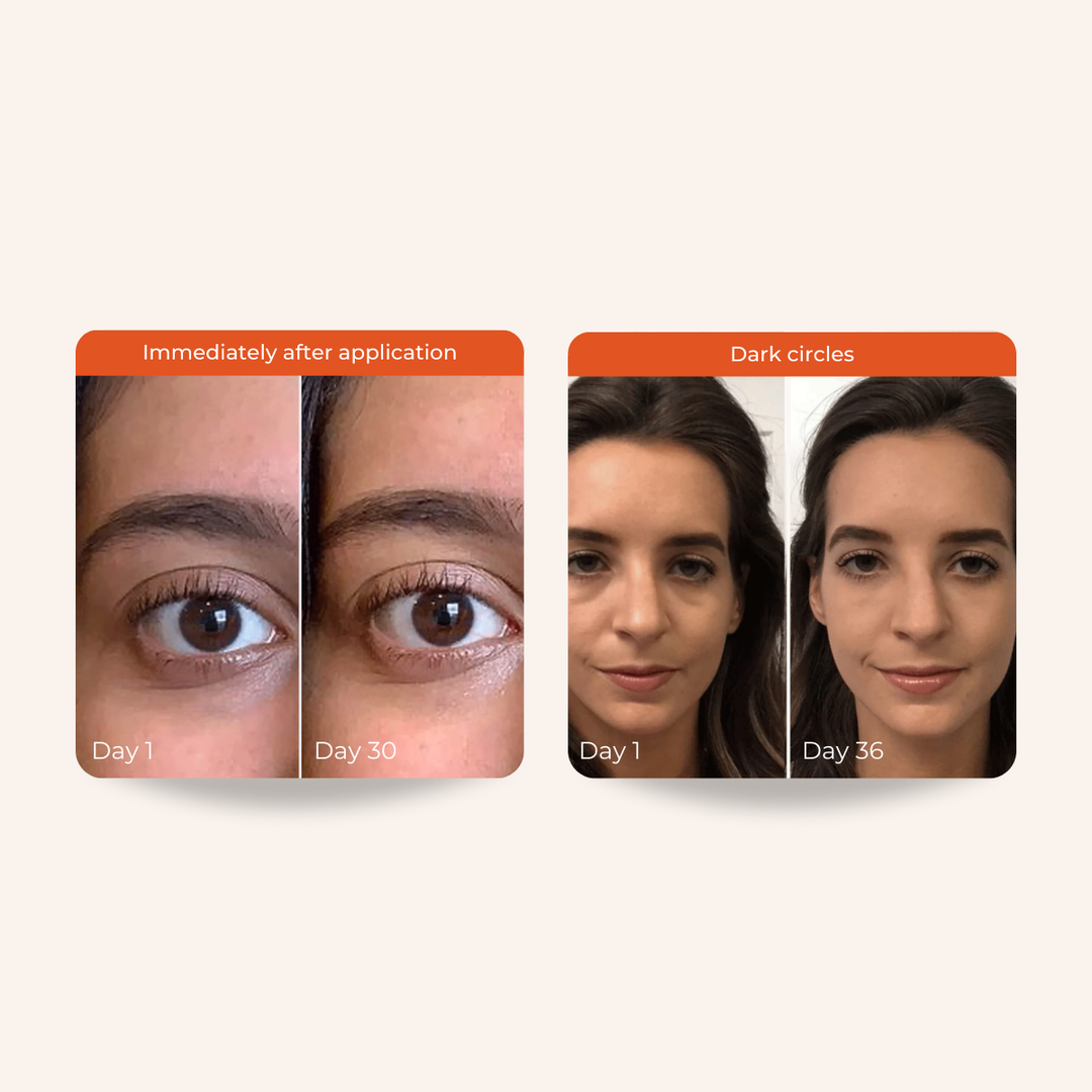 Skinvest DND Under Eye Mousse 7ml For Men & Women