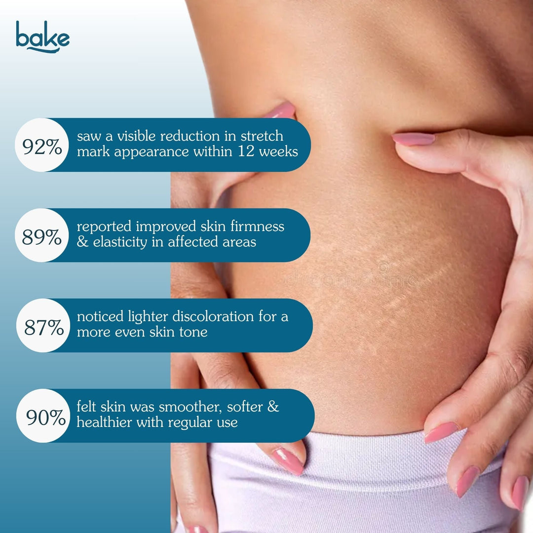 StriErase™ Stretch Marks Removal Roll On Serum - Suspire